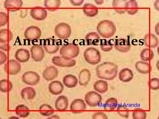 Anemias carenciales
Mario Arel Aranda
 