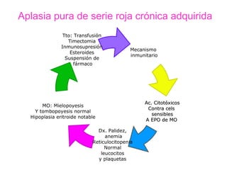 Aplasia pura de serie roja crónica adquirida
                Tto: Transfusión
                  Timectomia
               Inmunosupresión
                                           Mecanismo
                   Esteroides
                                           inmunitario
                 Suspensión de
                     fármaco




                                                Ac. Citotóxicos
       MO: Mielopoyesis
                                                 Contra cels
    Y tombopoyesis normal
                                                   sensibles
  Hipoplasia eritroide notable
                                                A EPO de MO

                              Dx. Palidez,
                                 anemia
                            Reticulocitopenia
                                 Normal
                               leucocitos
                              y plaquetas
 