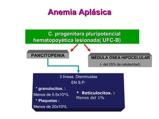 Anemia Aplásica

     C. progenitora pluripotencial
hematopoyética lesionada( UFC-B)

PANCITOPENIA                      MÉDULA ÓSEA HIPOCELULAR
                                         (- del 25% de celularidad)


                 3 líneas. Disminuidas
                        EN S.P:
 * granulocitos. :
Menos de 0.5x109//L       * Reticulocitos. :
                          Menos del 1%
 * Plaquetas :
Menos de 20x109/L
 