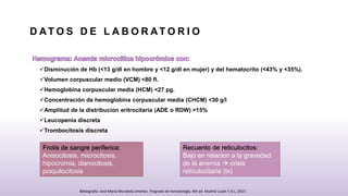 D AT O S D E L A B O R AT O R I O
Disminución de Hb (<13 g/dl en hombre y <12 g/dl en mujer) y del hematocrito (<43% y <35%).
Volumen corpuscular medio (VCM) <80 fl.
Hemoglobina corpuscular media (HCM) <27 pg.
Concentración de hemoglobina corpuscular media (CHCM) <30 g/l
Amplitud de la distribucion eritrocitaria (ADE o RDW) >15%
Leucopenia discreta
Trombocitosis discreta
Frotis de sangre periferica:
Anisocitosis, microcitosis,
hipocromia, dianocitosis,
poiquilocitosis
Recuento de reticulocitos:
Bajo en relacion a la gravedad
de la anemia  crisis
reticulocitaria (tx)
Bibliografia: José María Moraleda Jiménez. Pregrado de hematología. 4th ed. Madrid Luzán 5 D.L; 2017.
 