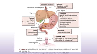 Bibliografia: José María Moraleda Jiménez. Pregrado de hematología. 4th ed. Madrid Luzán 5 D.L; 2017.
 