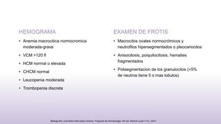 HEMOGRAMA
• Anemia macrocitica normocromica
moderada-grave
• VCM >120 fl
• HCM normal o elevada
• CHCM normal
• Leucopenia moderada
• Trombopenia discreta
EXAMEN DE FROTIS
• Macrocitos ovales normocrómicos y
neutrofilos hipersegmentados o pleocariocitos
• Anisocitosis, poiquilocitosis, hematies
fragmentados
• Polisegmentacion de los granulocitos (>5%
de neutros tiene 5 o mas lobulos)
Bibliografia: José María Moraleda Jiménez. Pregrado de hematología. 4th ed. Madrid Luzán 5 D.L; 2017.
 