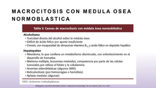 M A C R O C I T O S I S C O N M E D U L A O S E A
N O R M O B L A S T I C A
Bibliografia: José María Moraleda Jiménez. Pregrado de hematología. 4th ed. Madrid Luzán 5 D.L; 2017.
 