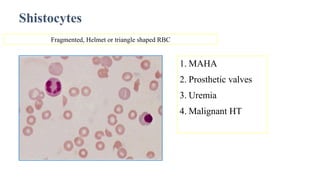 Anemia seminar final prevention types based on age | PPTX