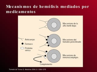 Mecanismos de hemólisis mediados por medicamentos Tomado de Torres G. Medicine 2004; 9: 1269-1276 
