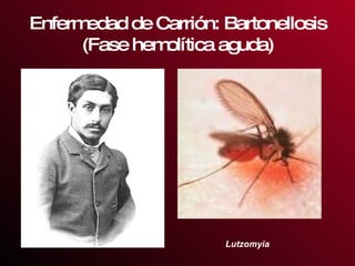 Enfermedad de Carrión: Bartonellosis (Fase hemolítica aguda) Lutzomyia 