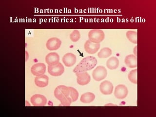 Bartonella bacilliformes Lámina periférica: Punteado basófilo 