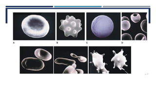 Comprehensive Overview of Congenital and Acquired Hemolytic Anemias | PPTX
