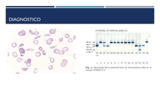 Comprehensive Overview of Congenital and Acquired Hemolytic Anemias | PPTX