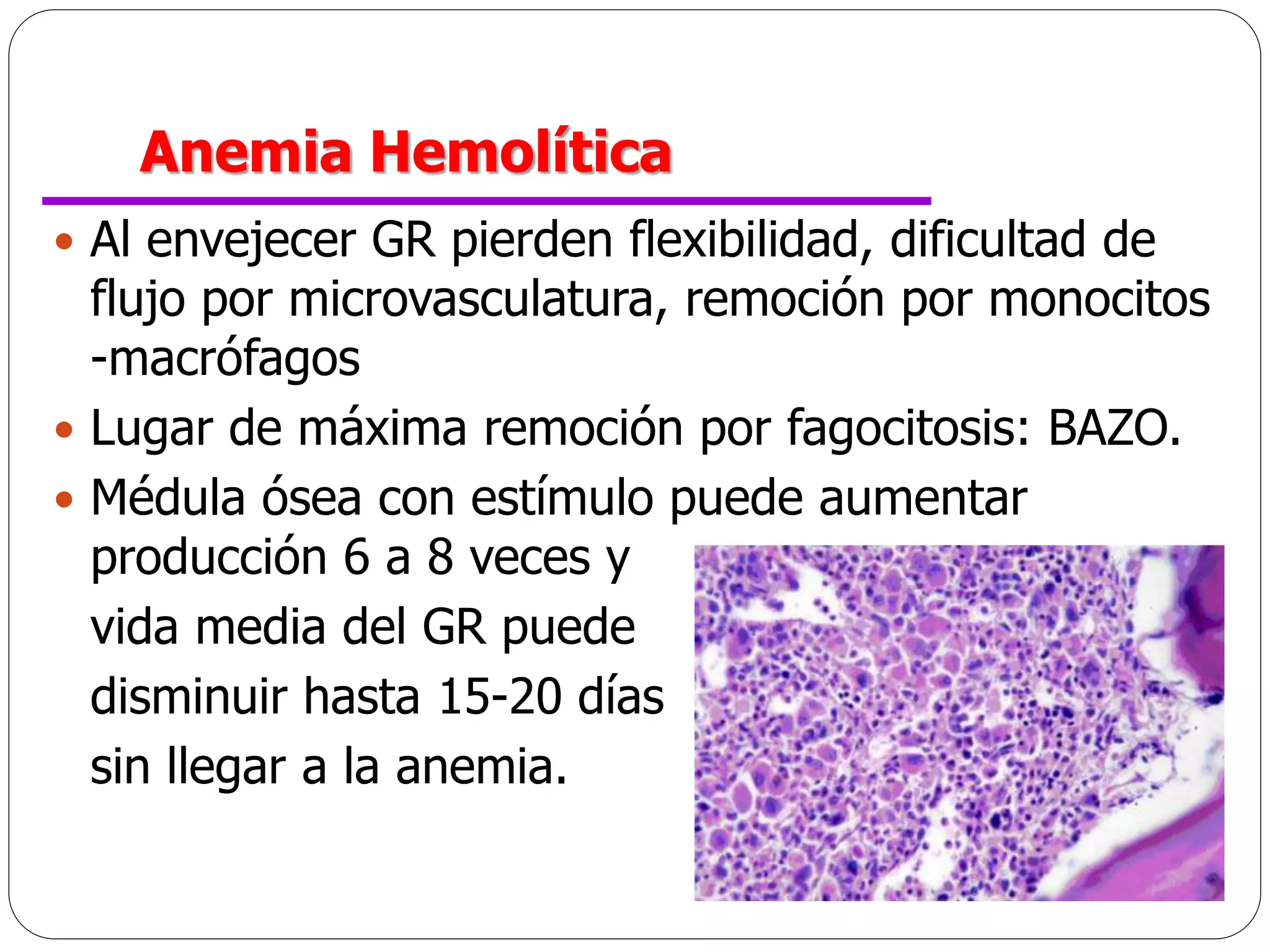 Anemias HEMOLÍTICA.ppt