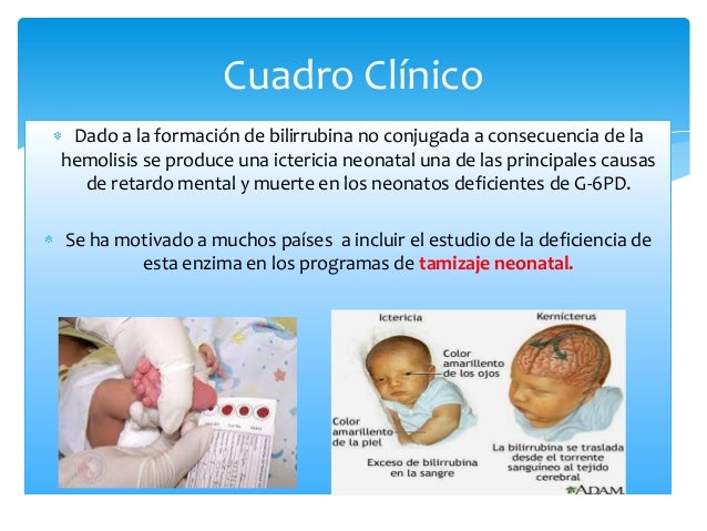 Deficiencia de glucosa 6 fosfato deshidrogenasa