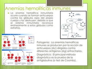 Anemias hemolíticas inmunes
Patogenia: La anemias hemolíticas
inmunes se producen por la acción de
anticuerpos (Ac) dirigidos contra
diferentes antígenos (Ag) eritrocitarios.
Diagnóstico: El principal método
diagnóstico es la prueba de la
antiglobulina (o test de Coombs).
 La anemia hemolítica inmunitaria
ocurre cuando se forman anticuerpos
contra los glóbulos rojos del propio
cuerpo y los destruyen, debido a que
el sistema inmunitario reconoce
erróneamente a estos glóbulos como
extraños.
 