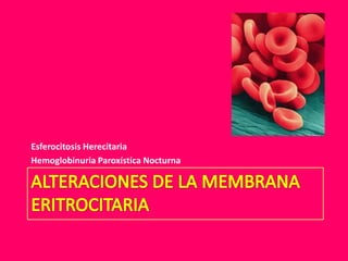Esferocitosis Herecitaria
Hemoglobinuria Paroxística Nocturna

 