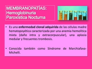 • Es una enfermedad clonal adquirida de las células madre
hematopoyética caracterizada por una anemia hemolítica
mixta (daño intra y extracorpuscular), una aplasia
medular y frecuentes trombosis.
• Conocida también como Síndrome de MarchiafavaMichelli.

 