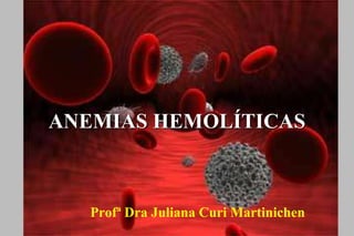 ANEMIAS HEMOLÍTICAS
Profª Dra Juliana Curi Martinichen
 