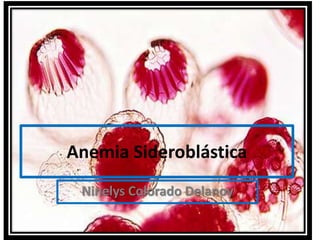 Anemia Sideroblástica
 Ninelys Colorado Delanoy
 