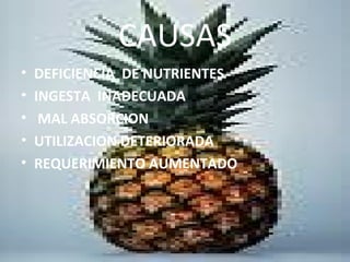 CAUSAS
• DEFICIENCIA DE NUTRIENTES
• INGESTA INADECUADA
• MAL ABSORCION
• UTILIZACION DETERIORADA
• REQUERIMIENTO AUMENTADO
 