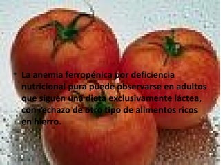 • La anemia ferropénica por deficiencia
nutricional pura puede observarse en adultos
que siguen una dieta exclusivamente láctea,
con rechazo de otro tipo de alimentos ricos
en hierro.
 