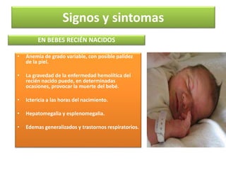 Signos y sintomas 
EN BEBES RECIÉN NACIDOS 
• Anemia de grado variable, con posible palidez 
de la piel. 
• La gravedad de la enfermedad hemolítica del 
recién nacido puede, en determinadas 
ocasiones, provocar la muerte del bebé. 
• Ictericia a las horas del nacimiento. 
• Hepatomegalia y esplenomegalia. 
• Edemas generalizados y trastornos respiratorios. 
 