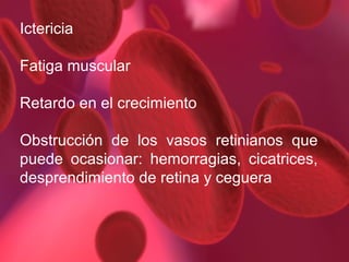 Ictericia
Fatiga muscular
Retardo en el crecimiento
Obstrucción de los vasos retinianos que
puede ocasionar: hemorragias, cicatrices,
desprendimiento de retina y ceguera

 