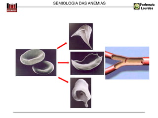 SEMIOLOGIA DAS ANEMIAS
 
