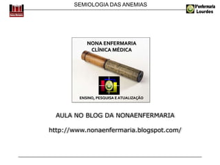 SEMIOLOGIA DAS ANEMIAS
AULA NO BLOG DA NONAENFERMARIA
http://www.nonaenfermaria.blogspot.com/
 