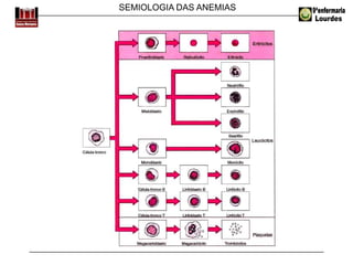 SEMIOLOGIA DAS ANEMIAS
 