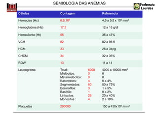 SEMIOLOGIA DAS ANEMIAS
Células Contagem Referencia
Hemacias (Hc) 6.6.106 4,5 a 5,5 x 106 mm3
Hemoglobina (Hb) 17,3 12 a 16 g/dl
Hematócrito (Ht) 55 35 a 47%
VCM 82 82 a 98 fl
HCM 33 26 a 34pg
CHCM 34 32 a 36%
RDW 13 11 a 14
Leucograma Total:
Mielócitos:
Metamielócitos:
Bastonetes:
Segmentados:
Eosinofilos:
Basófilo:
Linfocitos:
Monocitos :
6000
0
0
4
60
3
1
28
4
4000 a 10000 mm3
0
0
0 a 4%
50 a 75%
1 a 5%
0 a 2%
20 a 40%
2 a 10%
Plaquetas 200000 150 a 450x106 /mm3
 