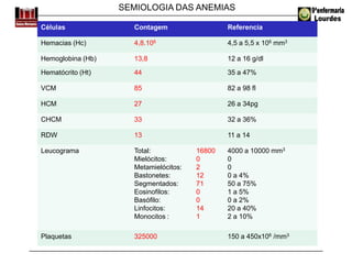 SEMIOLOGIA DAS ANEMIAS
Células Contagem Referencia
Hemacias (Hc) 4,8.106 4,5 a 5,5 x 106 mm3
Hemoglobina (Hb) 13,8 12 a 16 g/dl
Hematócrito (Ht) 44 35 a 47%
VCM 85 82 a 98 fl
HCM 27 26 a 34pg
CHCM 33 32 a 36%
RDW 13 11 a 14
Leucograma Total:
Mielócitos:
Metamielócitos:
Bastonetes:
Segmentados:
Eosinofilos:
Basófilo:
Linfocitos:
Monocitos :
16800
0
2
12
71
0
0
14
1
4000 a 10000 mm3
0
0
0 a 4%
50 a 75%
1 a 5%
0 a 2%
20 a 40%
2 a 10%
Plaquetas 325000 150 a 450x106 /mm3
 