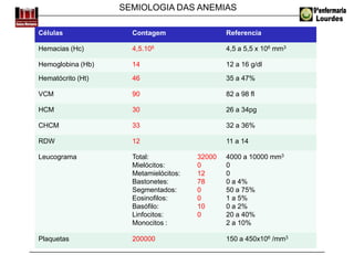 SEMIOLOGIA DAS ANEMIAS
Células Contagem Referencia
Hemacias (Hc) 4,5.106 4,5 a 5,5 x 106 mm3
Hemoglobina (Hb) 14 12 a 16 g/dl
Hematócrito (Ht) 46 35 a 47%
VCM 90 82 a 98 fl
HCM 30 26 a 34pg
CHCM 33 32 a 36%
RDW 12 11 a 14
Leucograma Total:
Mielócitos:
Metamielócitos:
Bastonetes:
Segmentados:
Eosinofilos:
Basófilo:
Linfocitos:
Monocitos :
32000
0
12
78
0
0
10
0
4000 a 10000 mm3
0
0
0 a 4%
50 a 75%
1 a 5%
0 a 2%
20 a 40%
2 a 10%
Plaquetas 200000 150 a 450x106 /mm3
 
