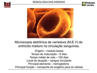 SEMIOLOGIA DAS ANEMIAS
Microscopia eletrônica de varredura (M.E.V) de
eritrócito maduro na circulação sanguínea.
Origem – medula óssea
Tempo de maturação – 8 dias
Tempo médio de vida – 120 dias
Local de atuação – sangue circulante
Principal elemento – hemoglobina
Principal função – transporte de oxigênio para as células
 
