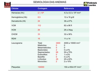 SEMIOLOGIA DAS ANEMIAS
Células Contagem Referencia
Hemacias (Hc) 2,1.106 4,5 a 5,5 x 106 mm3
Hemoglobina (Hb) 8,5 12 a 16 g/dl
Hematócrito (Ht) 24 36 a 47%
VCM 112 82 a 96 fl
HCM 26 26 a 34pg
CHCM 33 32 a 36%
RDW 16 11 a 14
Leucograma Total:
Mielócitos:
Metamielócitos:
Bastonetes:
Segmentados:
Eosinofilos:
Basófilo:
Linfocitos:
Monocitos :
3400
0
0
2
68
0
0
28
2
4000 a 10000 mm3
0
0
0 a 4%
50 a 75%
1 a 5%
0 a 2%
20 a 40%
2 a 10%
Plaquetas 130000 150 a 450x106 /mm3
 