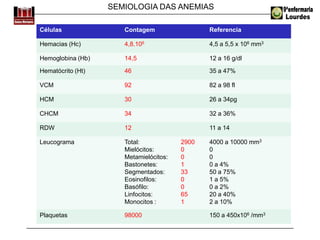 SEMIOLOGIA DAS ANEMIAS
Células Contagem Referencia
Hemacias (Hc) 4,8.106 4,5 a 5,5 x 106 mm3
Hemoglobina (Hb) 14,5 12 a 16 g/dl
Hematócrito (Ht) 46 35 a 47%
VCM 92 82 a 98 fl
HCM 30 26 a 34pg
CHCM 34 32 a 36%
RDW 12 11 a 14
Leucograma Total:
Mielócitos:
Metamielócitos:
Bastonetes:
Segmentados:
Eosinofilos:
Basófilo:
Linfocitos:
Monocitos :
2900
0
0
1
33
0
0
65
1
4000 a 10000 mm3
0
0
0 a 4%
50 a 75%
1 a 5%
0 a 2%
20 a 40%
2 a 10%
Plaquetas 98000 150 a 450x106 /mm3
 