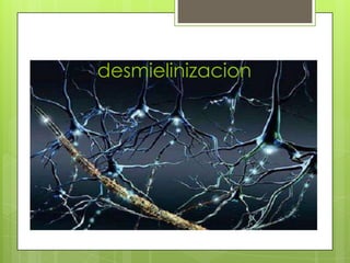 desmielinizacion

 