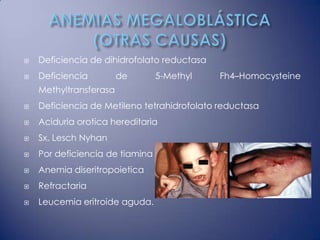    Deficiencia de dihidrofolato reductasa
   Deficiencia         de       5-Methyl    Fh4–Homocysteine
    Methyltransferasa
   Deficiencia de Metileno tetrahidrofolato reductasa
   Aciduria orotica hereditaria
   Sx. Lesch Nyhan
   Por deficiencia de tiamina
   Anemia diseritropoietica
   Refractaria
   Leucemia eritroide aguda.
 