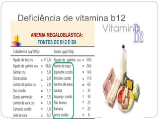 Deficiência de vitamina b12
 
