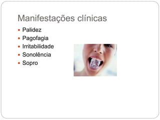 Manifestações clínicas
 Palidez
 Pagofagia
 Irritabilidade
 Sonolência
 Sopro
 