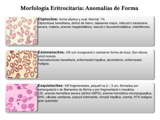 Eliptocitos: forma elíptica y oval. Normal: 1%
Eliptocitosis hereditaria, déficit de hierro, talasemia mayor, infecció n bacteriana
severa, malaria, anemia megaloblástica, reacció n leucoeritroblástica, mielofibrosis.
Estomatocitos: GR con invaginació n central en forma de boca. Son discos
unicó ncavos.
Estomatocitosis hereditaria, enfermedad hepática, alcoholismo, enfermedad
maligna.
Esquistocitos: GR fragmentados, pequeñ os 2 – 3 um, formados por
estrangulació n de filamentos de fibrina o por fragmentació n mecánica.
CID, anemia hemolítica severa (déficit G6PD), anemia hemolítica microangiopática,
SHU, válvulas cardiacas, púrpura fulminante, cirrosis hepática, uremia, HTA maligna,
gran quemado.
Morfología Eritrocitaria: Anomalías de Forma
 