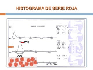 HISTOGRAMA DE SERIE ROJA
ADE
VCM
 