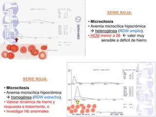 SERIE ROJA:
• Microcitosis
• Anemia microcítica hipocrómica
 heterogénea (RDW amplio).
• HCM menor a 26  valor muy
sensible a déficit de hierro
SERIE ROJA:
• Microcitosis
• Anemia microcítica hipocrómica
 homogénea (RDW estrecho).
• Valorar dinámica de hierro y
respuesta a tratamiento, o
• Investigar Hb anormales
 