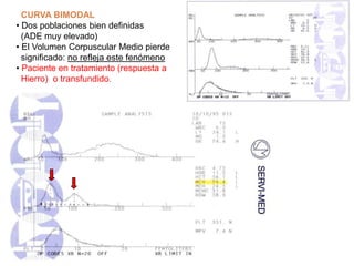 CURVA BIMODAL
• Dos poblaciones bien definidas
(ADE muy elevado)
• El Volumen Corpuscular Medio pierde
significado: no refleja este fenómeno
• Paciente en tratamiento (respuesta a
Hierro) o transfundido.
 