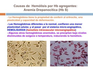 - La Hemoglobina tiene la propiedad de conferir al eritrocito, una
plasticidad y capacidad de deformación.
- Las Hemoglobinas diferentes a la normal, confieren una menor
plasticidad celular, y al pasar por el sistema micro-angiopático,
HEMOLISARAN (hemolisis intravascular microangiopática)
- Algunas otras hemoglobinas anormales, se precipitan bajo niveles
disminuidos de oxígeno o temperatura, induciendo la hemólisis.
Causas de Hemólisis por Hb agregantes:
Anemia Drepanocítica (Hb S)
 