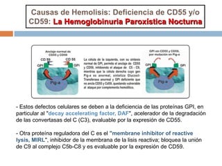 Causas de Hemolisis: Deficiencia de CD55 y/o
CD59: La Hemoglobinuria Paroxística Nocturna
- Estos defectos celulares se deben a la deficiencia de las proteínas GPI, en
particular al "decay accelerating factor, DAF", acelerador de la degradación
de las convertasas del C (C3), evaluable por la expresión de CD55.
- Otra proteína reguladora del C es el "membrane inhibitor of reactive
lysis, MIRL", inhibidor de la membrana de la lisis reactiva; bloquea la unión
de C9 al complejo C5b-C8 y es evaluable por la expresión de CD59.
 