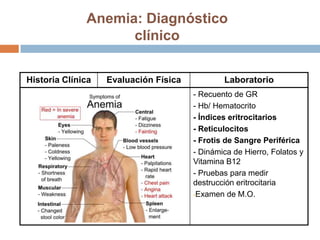 Anemia: Diagnóstico
clínico
Historia Clínica Evaluación Física Laboratorio
- Recuento de GR
- Hb/ Hematocrito
- Índices eritrocitarios
- Reticulocitos
- Frotis de Sangre Periférica
- Dinámica de Hierro, Folatos y
Vitamina B12
- Pruebas para medir
destrucción eritrocitaria
-Examen de M.O.
 