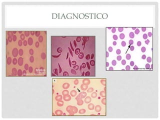 DIAGNOSTICO
 