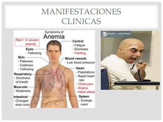 MANIFESTACIONES
CLINICAS
 