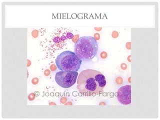 MIELOGRAMA
 