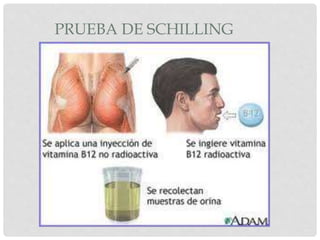 PRUEBA DE SCHILLING
 