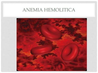 ANEMIA HEMOLITICA
 