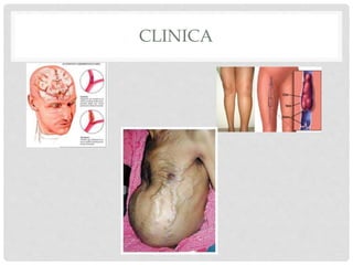 CLINICA
 